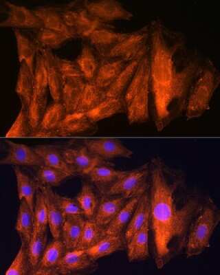 Immunocytochemistry/ Immunofluorescence: ch-TOG Antibody - BSA Free [NBP2-92555]