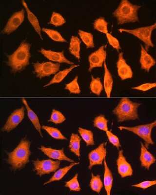 Immunocytochemistry/ Immunofluorescence: ch-TOG Antibody - BSA Free [NBP2-92555]