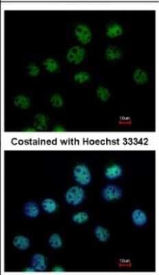 Immunocytochemistry/ Immunofluorescence: cleavage stimulation factor Antibody [NBP2-15913]