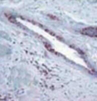 Immunohistochemistry: RB1 Antibody (172C1094) - (cleaved) [NB100-56598]