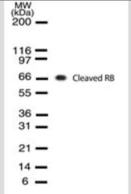 Western Blot: RB1 Antibody (172C1094)(cleaved) [NB100-56598]