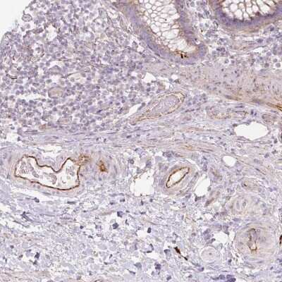 Immunohistochemistry-Paraffin: cyclin-I2 Antibody [NBP2-30765]
