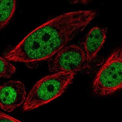 Immunocytochemistry/ Immunofluorescence: cysteine/histidine-rich 1 Antibody [NBP2-56486]