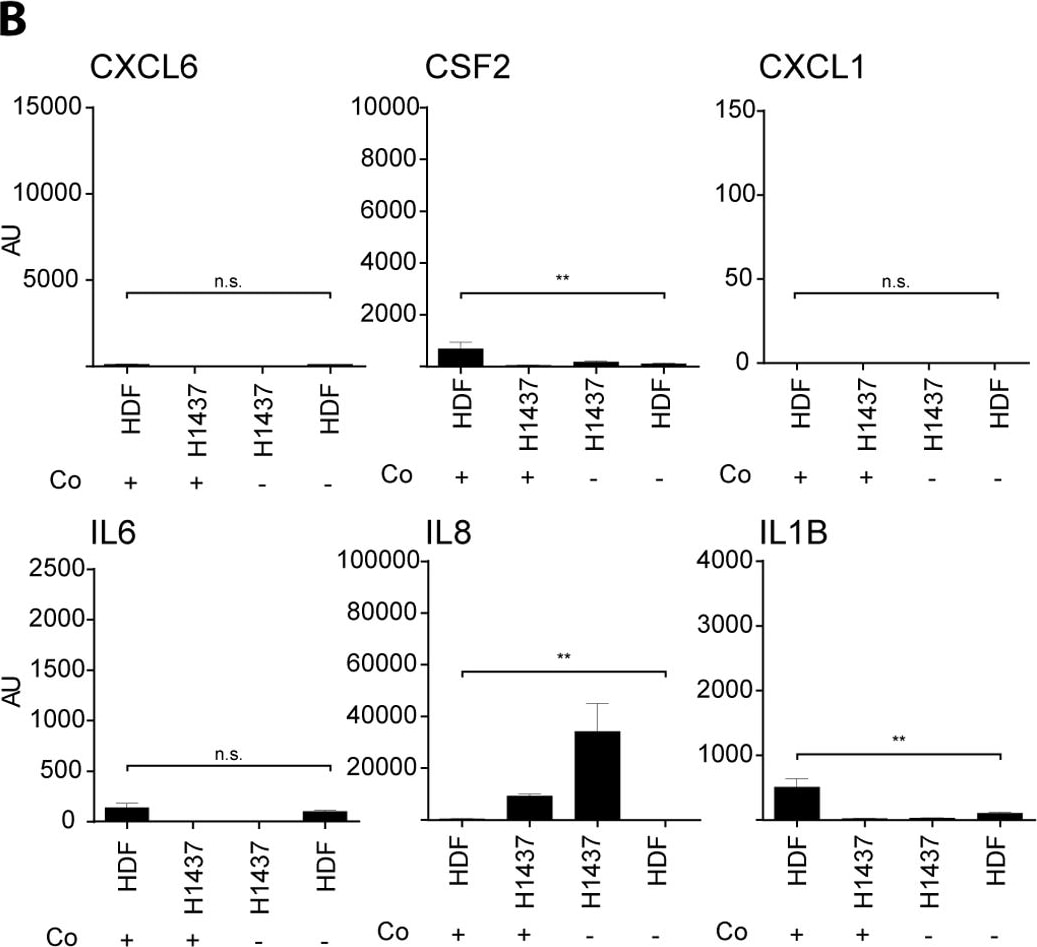 Detection of Human Human IL-6 Quantikine ELISA Kit by PCR