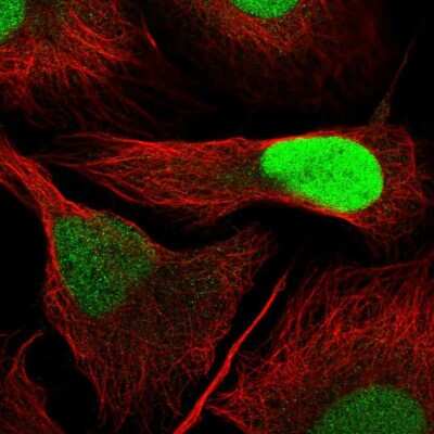 Immunocytochemistry/ Immunofluorescence: dUTPase Antibody [NBP2-33277]