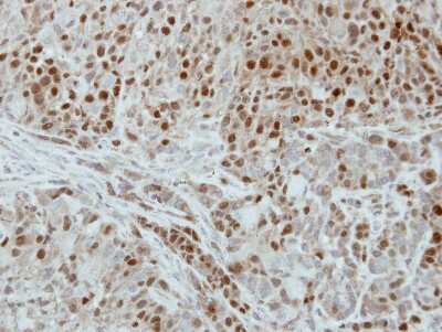 Immunohistochemistry-Paraffin: dUTPase Antibody [NBP2-16241]