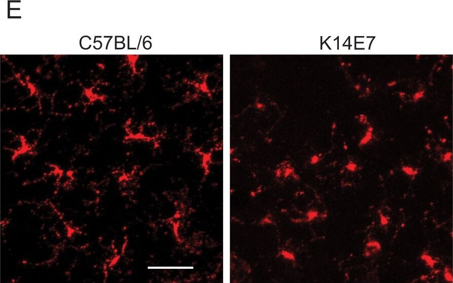 Langerin/CD207 Antibody (929F3.01)