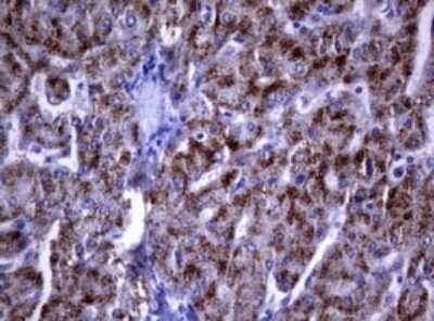 Immunohistochemistry: dedicator of cytokinesis 8 Antibody (OTI12D7) - Azide and BSA Free [NBP2-72227]