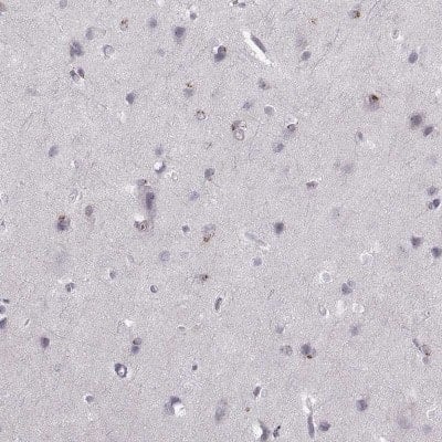 Immunohistochemistry: delta Opioid R/OPRD1 Antibody [NBP2-68910]