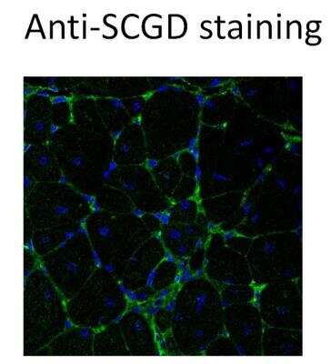 Immunocytochemistry/ Immunofluorescence: delta-Sarcoglycan Antibody (3G10) [H00006444-M01-100ug]