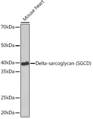Western Blot: delta-Sarcoglycan Antibody (3P3R4) [NBP3-16776]