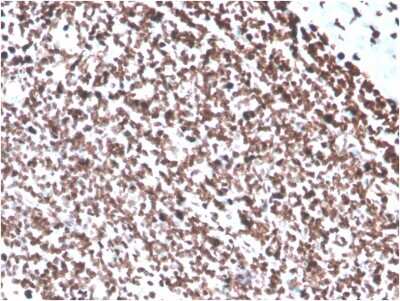 Immunohistochemistry-Paraffin: dsDNA Antibody (DSD/4054R) - Azide and BSA Free [NBP3-08490]