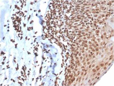 Immunohistochemistry-Paraffin: dsDNA Antibody (DSD/4054R) [NBP3-07302]