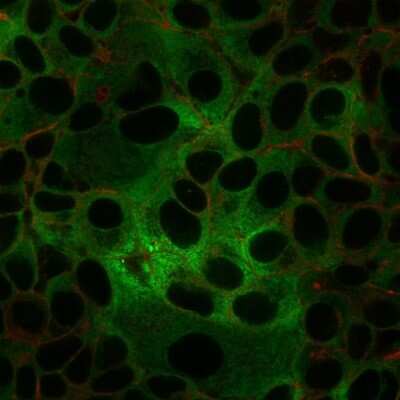 Immunocytochemistry/ Immunofluorescence: dsDNA Antibody (rDSD/4565) [NBP3-07670]