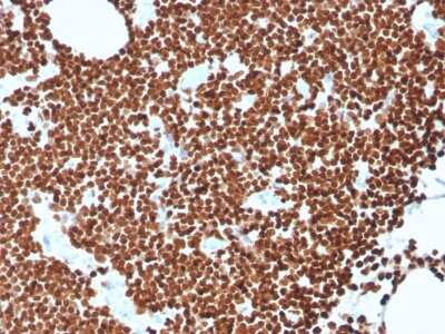 Immunohistochemistry-Paraffin: dsDNA Antibody (rDSD/4565) [NBP3-07670]