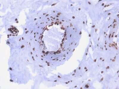 Immunohistochemistry-Paraffin: dsDNA Antibody (rDSD/4565) [NBP3-07670]
