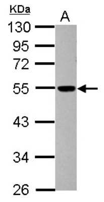 Western Blot: dynactin 4 Antibody [NBP2-16242]