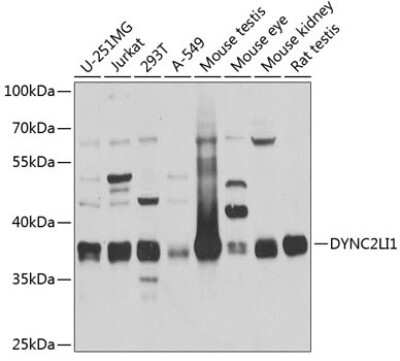 Western Blot: dynein, cytoplasmic 2, light intermediate chain 1 AntibodyBSA Free [NBP2-92447]
