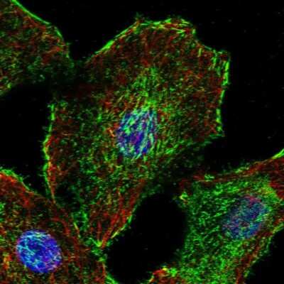 Immunocytochemistry/ Immunofluorescence: dystrophia myotonica containing WD repeat motif Antibody [NBP2-49548]