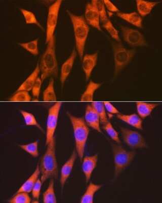 Immunocytochemistry/ Immunofluorescence: eEF-2 Antibody (4E2Z5) [NBP3-16866]