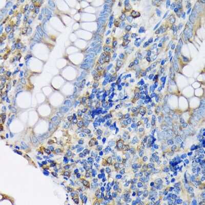 Immunohistochemistry-Paraffin: eEF-2 Antibody (4E2Z5) [NBP3-16866]