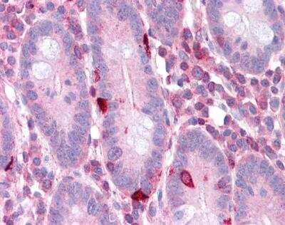 Immunohistochemistry-Paraffin: eEF-2 Antibody [NBP1-54383]