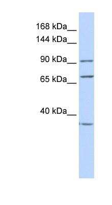 Western Blot: eEF-2 Antibody [NBP1-54383]