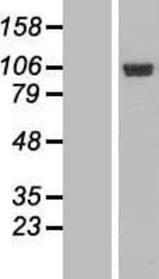 Western Blot: eEF1A2 binding protein Overexpression Lysate [NBP2-04981]