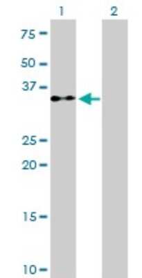 Western Blot: eIF2 alpha/EIF2S1 Antibody (3H12-C11) [H00001965-M01]
