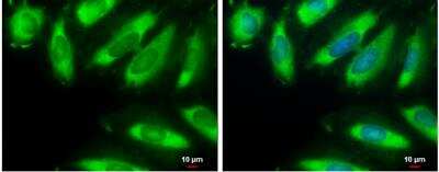 Immunocytochemistry/ Immunofluorescence: eIF2 alpha/EIF2S1 Antibody [NBP1-32289]