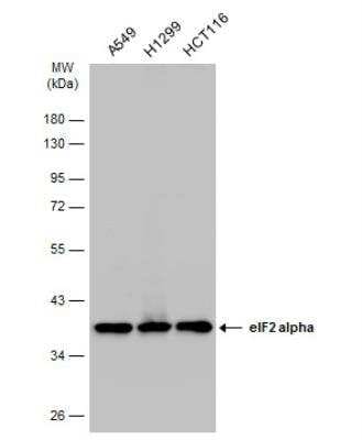 Western Blot: eIF2 alpha/EIF2S1 Antibody [NBP1-32289]