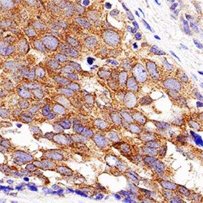Immunohistochemistry-Paraffin: eIF2A Antibody (3A7B11) [NBP2-26296]