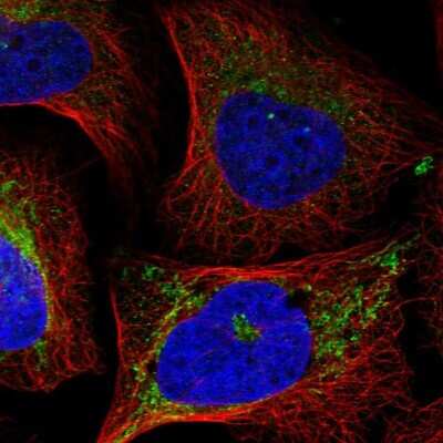 Immunocytochemistry/ Immunofluorescence: eIF2A Antibody [NBP1-84879]