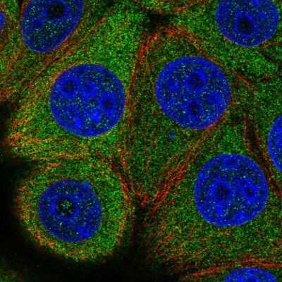 Immunocytochemistry/ Immunofluorescence: eIF2B epsilon Antibody [NBP2-56270]