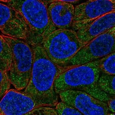 Immunocytochemistry/ Immunofluorescence: eIF2B epsilon Antibody [NBP2-56363]