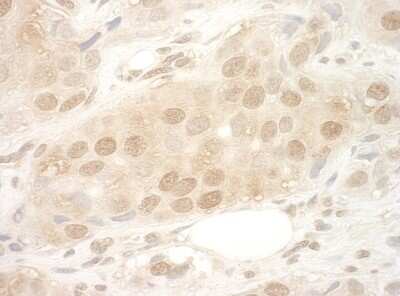 Immunohistochemistry-Paraffin: eIF2B epsilon Antibody [NBP1-30449]
