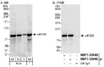 Western Blot: eIF2B epsilon Antibody [NBP1-30448]