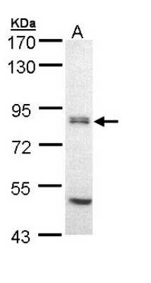 Western Blot: eIF2B epsilon Antibody [NBP1-32783]