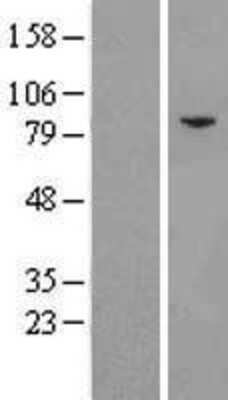 Western Blot: eIF2B epsilon Overexpression Lysate [NBL1-10181]