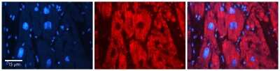 Immunohistochemistry: eIF2B1 Antibody [NBP1-57644]