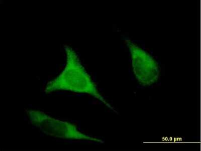Immunocytochemistry/ Immunofluorescence: eIF2B3 Antibody [H00008891-B01P]