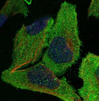 Immunocytochemistry/ Immunofluorescence: eIF2B3 Antibody [NBP1-83985]