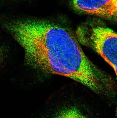 Immunocytochemistry/ Immunofluorescence: eIF2B3 Antibody [NBP1-83986]