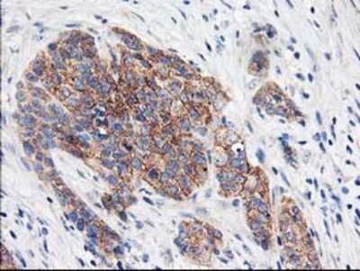 Immunohistochemistry: eIF2B3 Antibody (OTI1A4) - Azide and BSA Free [NBP2-71397]
