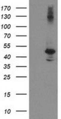 Western Blot: eIF2B3 Antibody (OTI1A4)Azide and BSA Free [NBP2-71397]