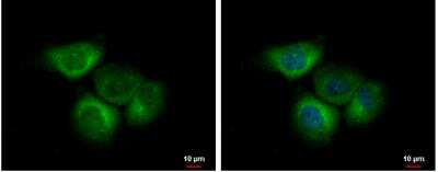 Immunocytochemistry/ Immunofluorescence: eIF2B4 Antibody [NBP2-16293]