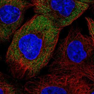 Immunocytochemistry/ Immunofluorescence: eIF3K Antibody [NBP2-56764]