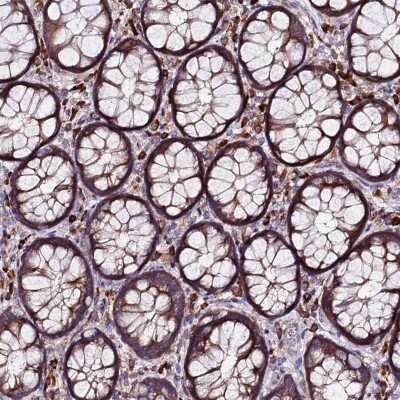 Immunohistochemistry-Paraffin: eIF3K Antibody [NBP1-91865]