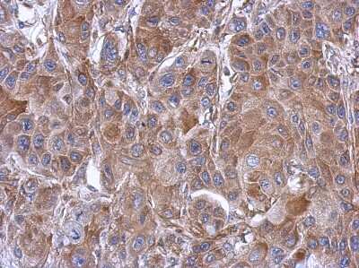 Immunohistochemistry-Paraffin: eIF3e Antibody [NBP2-16298]