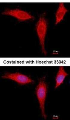 Immunocytochemistry/ Immunofluorescence: eIF4A1 Antibody [NBP2-16302]